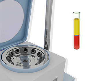 Platelet-Rich Plasma (PRP)