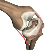 Meniscal Surgery