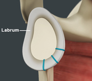 Shoulder Labrum Reconstruction